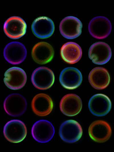 These are Drosophila embryos in dorsoventral cross-sectional views stained for a variety of morphogens. This view of embryos would have been difficult to obtain without the use of the microfluidic device. (Credit: Georgia Tech/Hang Lu)